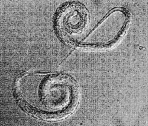 ����� (Dracunculus medinensis)